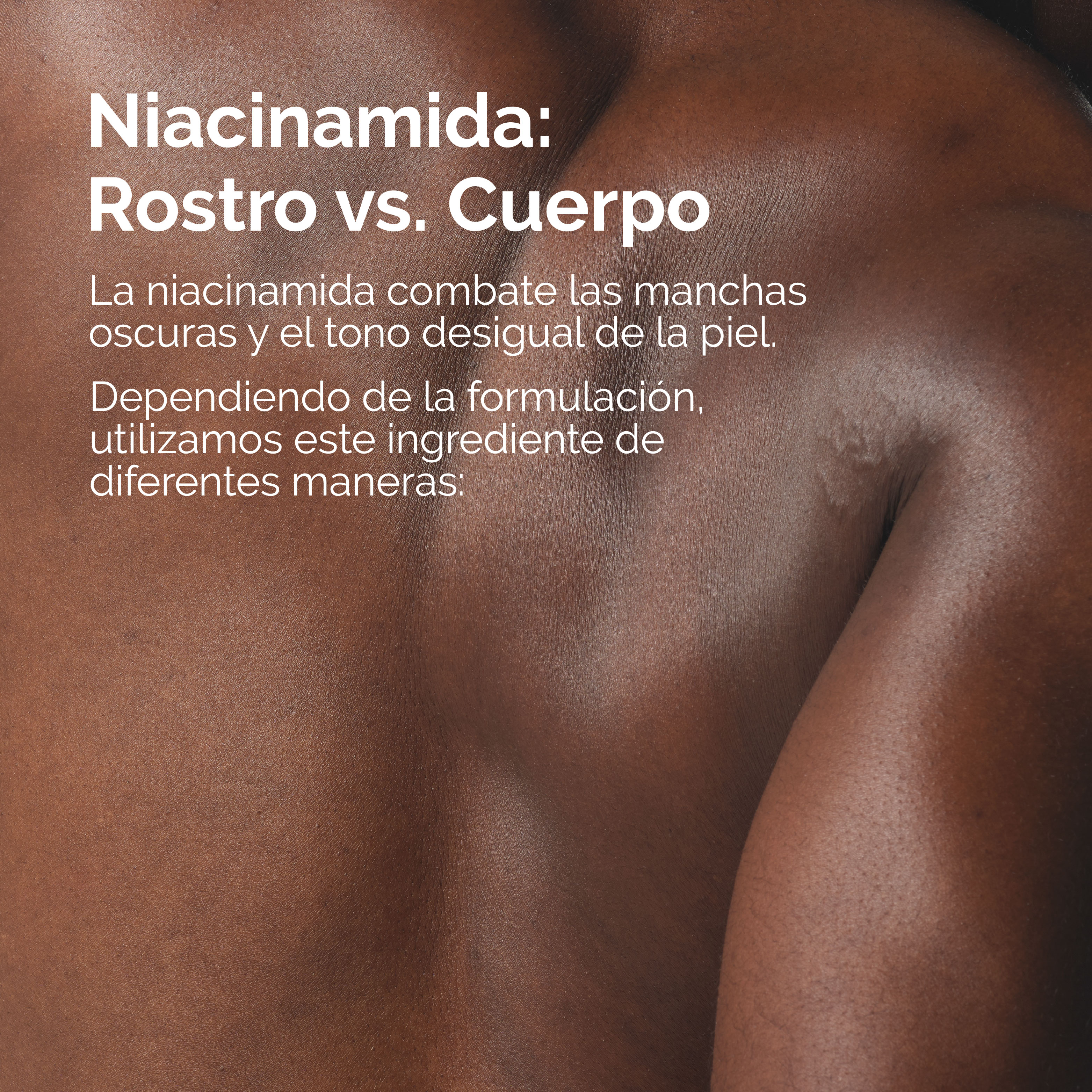 NIACINAMIDE 5% FACE AND BODY (EMULSIÓN PARA ROSTRO Y CUERPO CON NIACINAMIDA)